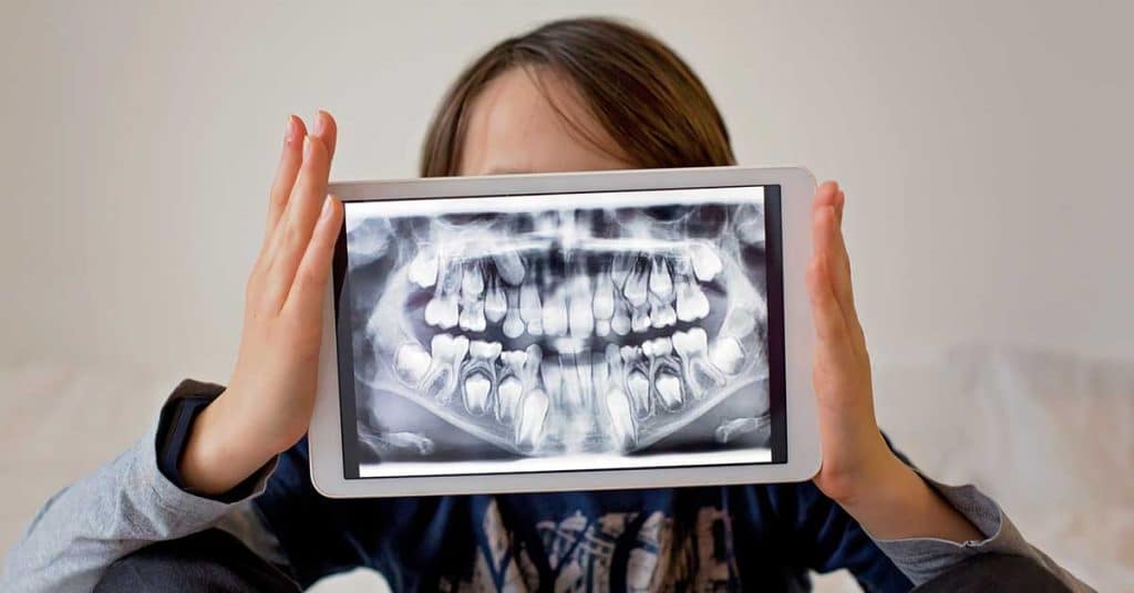 Why Do You Need Dental X-Rays
