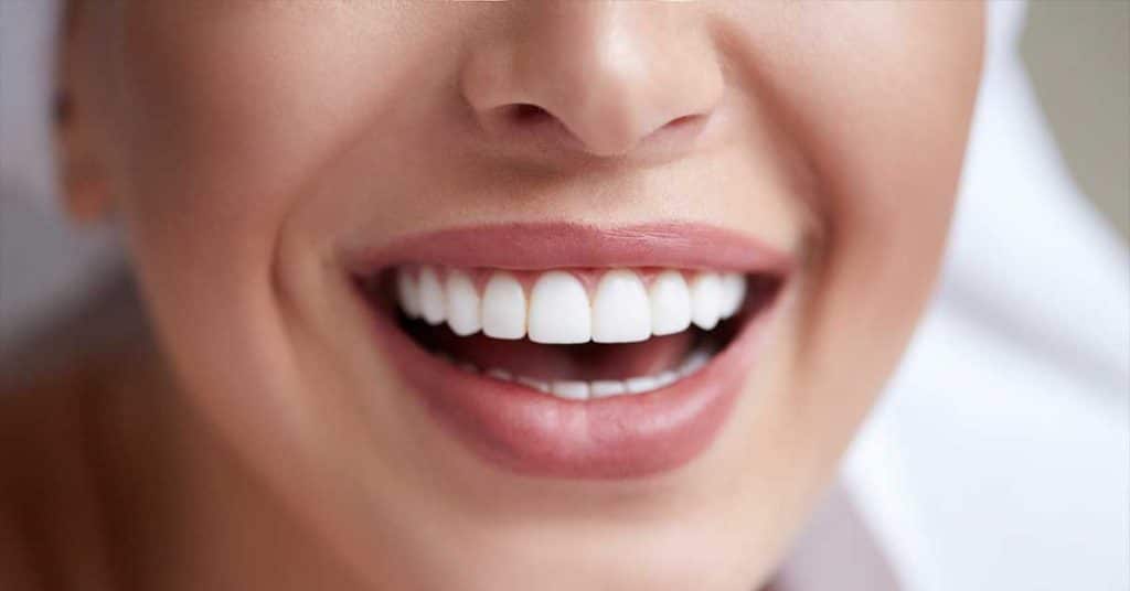 Is it Safe to Whiten Your Teeth